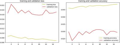 Automating bone loss measurement on periapical radiographs for predicting the periodontitis stage and grade